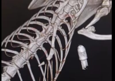 Wyniki tomografii Chii